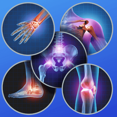 Joint Replacement (Knee & Hip) Surgery