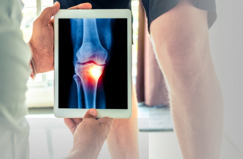 How to Prevent Infections After Knee Surgery?